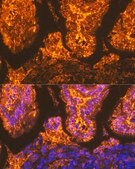 Anti-FABPI antibody produced in rabbit