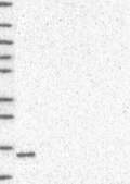 Anti-TSPO antibody produced in rabbit Prestige Antibodies&#174; Powered by Atlas Antibodies, affinity isolated antibody, buffered aqueous glycerol solution