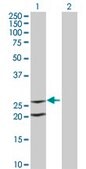 Monoclonal Anti-IL6 antibody produced in mouse clone 3E4, purified immunoglobulin, buffered aqueous solution