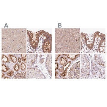 Anti-HIP1R antibody produced in rabbit Prestige Antibodies&#174; Powered by Atlas Antibodies, affinity isolated antibody, buffered aqueous glycerol solution