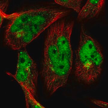 Anti-OTUD1 antibody produced in rabbit Prestige Antibodies&#174; Powered by Atlas Antibodies, affinity isolated antibody