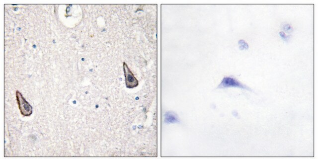 Anti-ADCY5 antibody produced in rabbit affinity isolated antibody