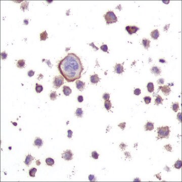 Anti-N-RAS antibody, Rabbit monoclonal clone SP174, recombinant, expressed in proprietary host, affinity isolated antibody