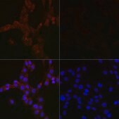 Anti-MAP1LC3B antibody produced in mouse