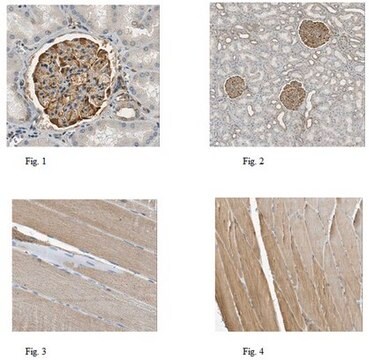 Anti-Parvin alpha Antibody, clone 7E2.1 clone 7E2.1, from mouse