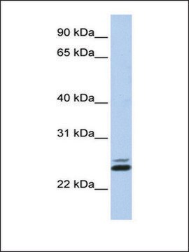 Anti-JAZF1 (AB1) antibody produced in rabbit affinity isolated antibody