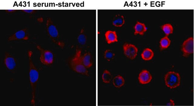 Anti-Phosphotyrosine antibody, Rabbit monoclonal recombinant, expressed in HEK 293 cells, clone RM111, purified immunoglobulin