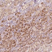 Anti-CYP11B2 antibody produced in rabbit Prestige Antibodies&#174; Powered by Atlas Antibodies, affinity isolated antibody, buffered aqueous glycerol solution