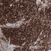 Anti-CD44 antibody produced in mouse Prestige Antibodies&#174; Powered by Atlas Antibodies, clone CL13318, purified by using Protein A, buffered aqueous glycerol solution