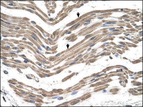 Anti-C1QB antibody produced in rabbit affinity isolated antibody