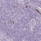 Anti-LYZ antibody produced in rabbit Prestige Antibodies&#174; Powered by Atlas Antibodies, affinity isolated antibody, buffered aqueous glycerol solution