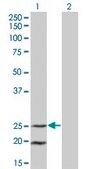 Monoclonal Anti-IL6, (C-terminal) antibody produced in mouse clone 3F4, purified immunoglobulin, buffered aqueous solution
