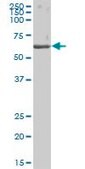 Anti-CES1 antibody produced in mouse purified immunoglobulin, buffered aqueous solution