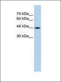 Anti-KRT17 antibody produced in rabbit affinity isolated antibody