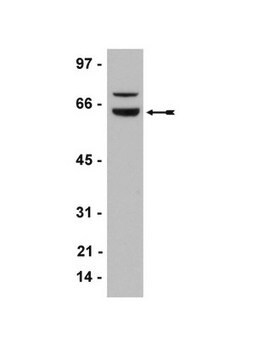 Anti-WT1 Antibody, clone 6F-H2 clone 6F-H2, Upstate&#174;, from mouse