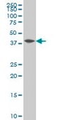 Monoclonal Anti-NFKBIB antibody produced in mouse clone 2B11, purified immunoglobulin, buffered aqueous solution