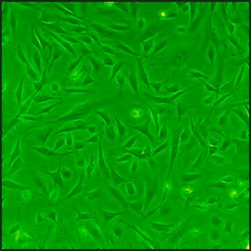 Rat Cardiac Fibroblasts: RCF, neonatal