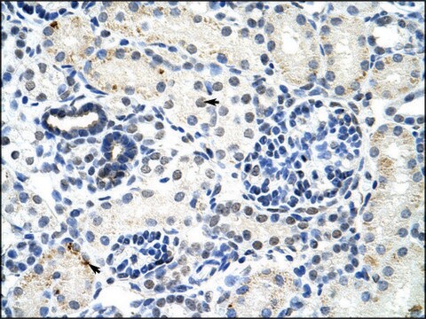 Anti-DDX17 antibody produced in rabbit IgG fraction of antiserum