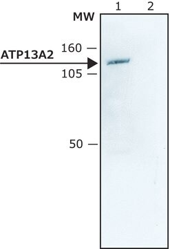 Anti-ATP13A2 (C-terminal) antibody produced in rabbit ~1.5&#160;mg/mL, affinity isolated antibody, buffered aqueous solution