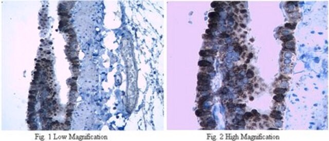 Anti-Surfactant Protein B Antibody from rabbit, purified by affinity chromatography