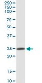 Anti-PSMB4 antibody produced in rabbit purified immunoglobulin, buffered aqueous solution