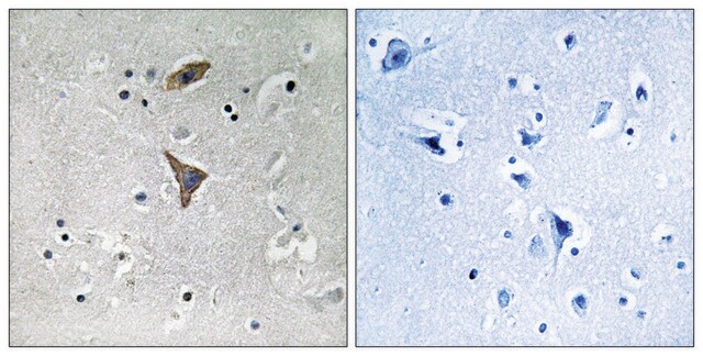 Anti-KCNT1 antibody produced in rabbit affinity isolated antibody