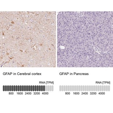 Anti-GFAP antibody produced in rabbit Prestige Antibodies&#174; Powered by Atlas Antibodies, affinity isolated antibody, buffered aqueous glycerol solution