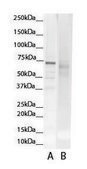 Anti-GCLC antibody produced in rabbit affinity isolated antibody