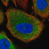 Anti-PYGB antibody produced in rabbit Prestige Antibodies&#174; Powered by Atlas Antibodies, affinity isolated antibody, buffered aqueous glycerol solution