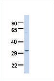Anti-SDHB antibody produced in rabbit affinity isolated antibody