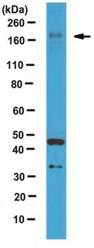 Anti-LTBP1 Antibody hinge region from rabbit, purified by affinity chromatography
