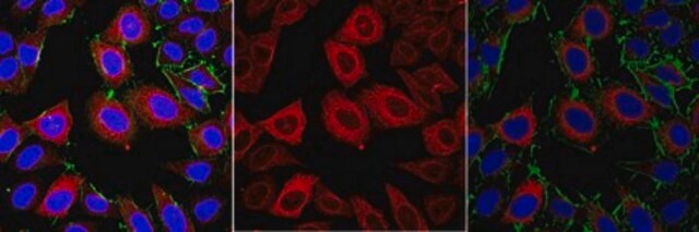 Anti-TACC3 Antibody from rabbit, purified by affinity chromatography