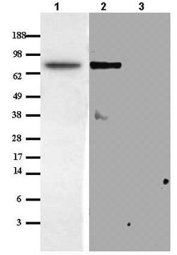 Anti-Matriptase/MT-SP1 Rabbit pAb liquid, Calbiochem&#174;