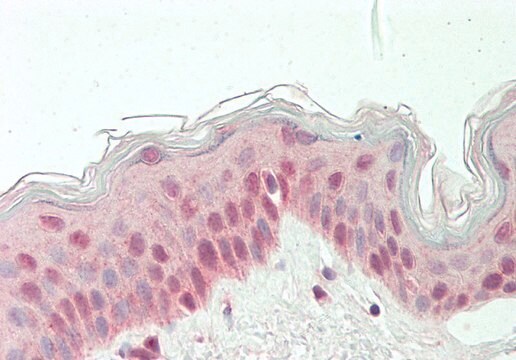 Anti-RARG antibody produced in rabbit affinity isolated antibody