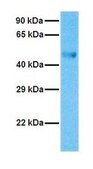 Anti-CYP2E1 affinity isolated antibody