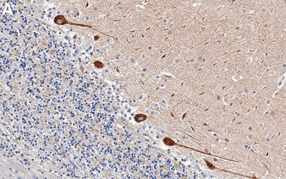 Anti-Myosin-10 Antibody, clone 1B3 ZooMAb&#174; Rabbit Monoclonal recombinant, expressed in HEK 293 cells