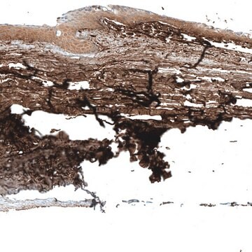 Anti-KERA antibody produced in rabbit Prestige Antibodies&#174; Powered by Atlas Antibodies, affinity isolated antibody, buffered aqueous glycerol solution