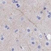 Anti-CACNG3 antibody produced in rabbit Prestige Antibodies&#174; Powered by Atlas Antibodies, affinity isolated antibody, buffered aqueous glycerol solution