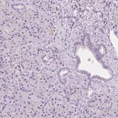 Anti-GABRD antibody produced in rabbit Prestige Antibodies&#174; Powered by Atlas Antibodies, affinity isolated antibody, buffered aqueous glycerol solution
