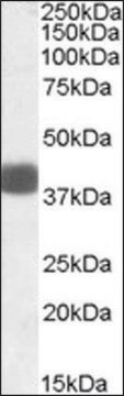 Anti-FBXO32 antibody produced in goat affinity isolated antibody, buffered aqueous solution