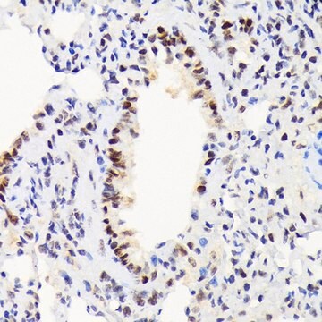 Anti-EWSR1 antibody produced in rabbit