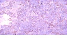 Anti-Casein Kinase 2&#945; Antibody, 1AD9 clone 1AD9, from mouse