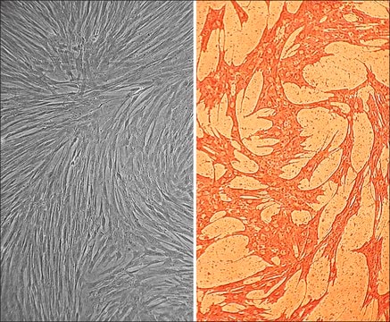 Porcine Coronary Artery Smooth Muscle Cells: PCASMC (Cryovial)