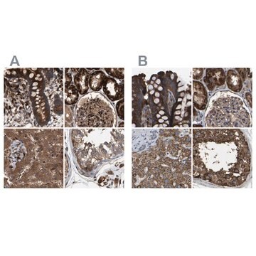 Anti-GCC1 antibody produced in rabbit Prestige Antibodies&#174; Powered by Atlas Antibodies, affinity isolated antibody, buffered aqueous glycerol solution