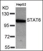 Anti-STAT6 (Ab-641) antibody produced in rabbit affinity isolated antibody