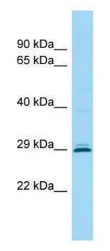 Anti-CEMP1 (C-terminal) antibody produced in rabbit affinity isolated antibody