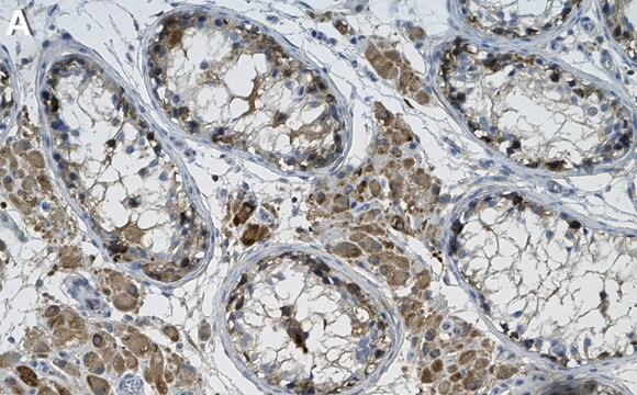 Anti-IKK&#949; Antibody, clone 1D7 ZooMAb&#174; Rabbit Monoclonal recombinant, expressed in HEK 293 cells