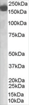 Anti-Complement Factor H antibody produced in goat affinity isolated antibody, buffered aqueous solution