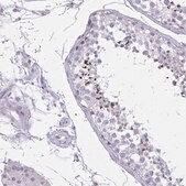 Anti-CARD9 antibody produced in rabbit Prestige Antibodies&#174; Powered by Atlas Antibodies, affinity isolated antibody, buffered aqueous glycerol solution