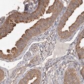 Anti-PKM antibody produced in rabbit Prestige Antibodies&#174; Powered by Atlas Antibodies, affinity isolated antibody, buffered aqueous glycerol solution